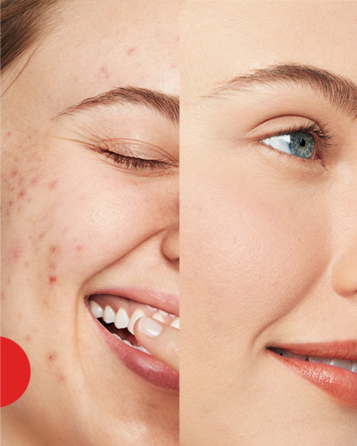 Twoja skóra będzie wyglądać naturlanie z podkładem Anti-Blemish Solutions Liquid Makeup - efekt przed i po użyciu podkładu